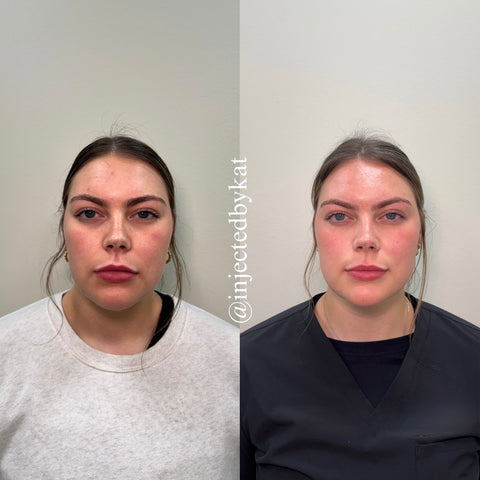 Before and after