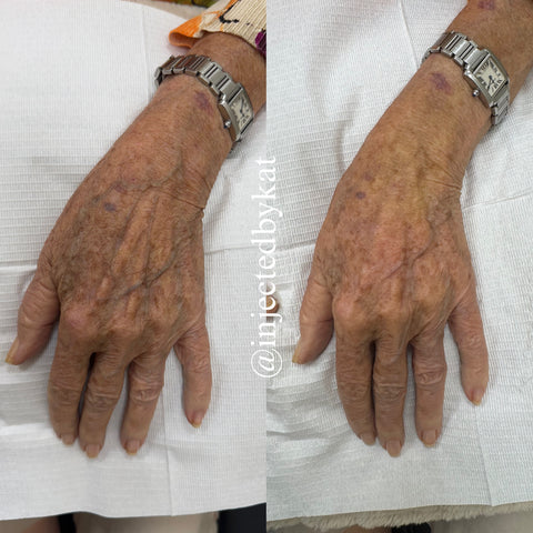 Before and after