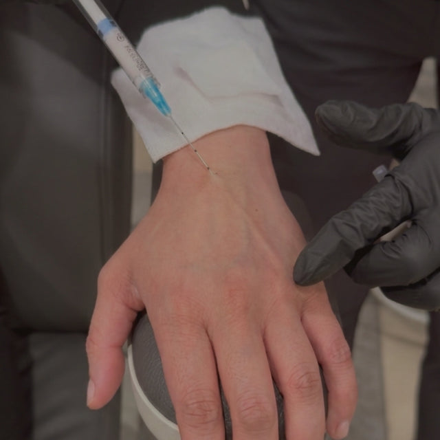 ARTE Hand Restoration