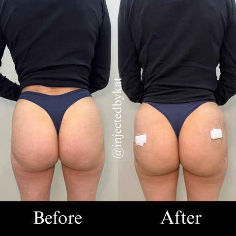 Before and after