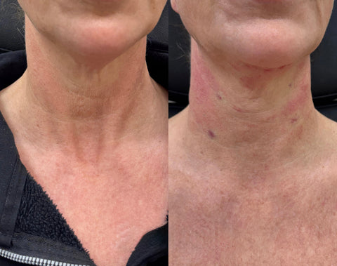 Before and after