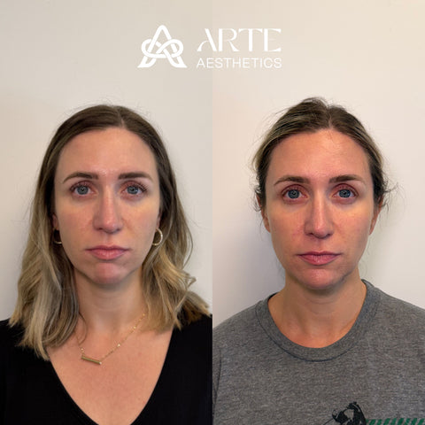 Before and after