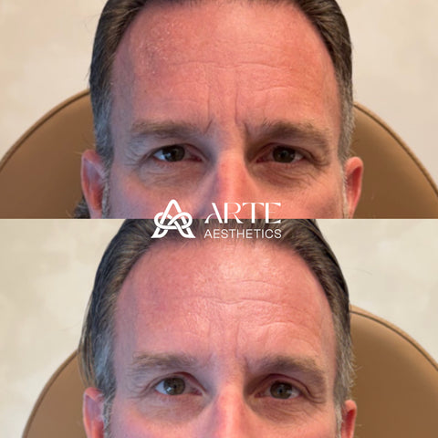 Before and after