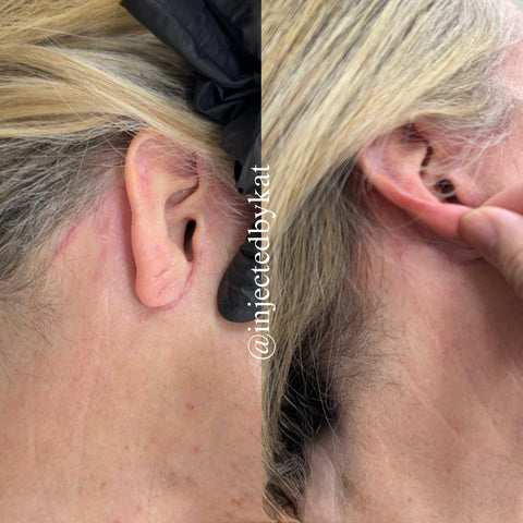Before and after