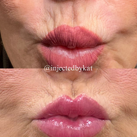 Before and after