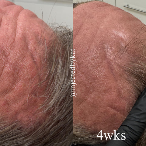 Before and after