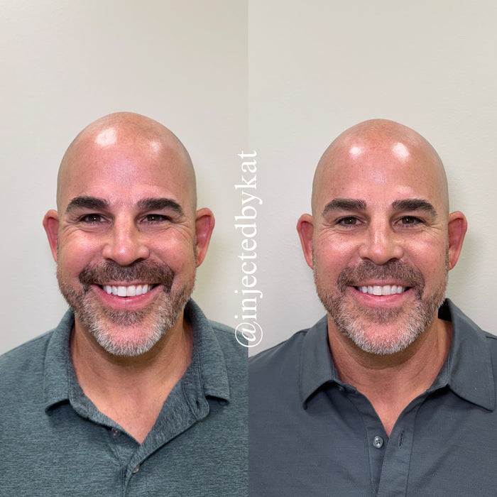 Collagen Restoration