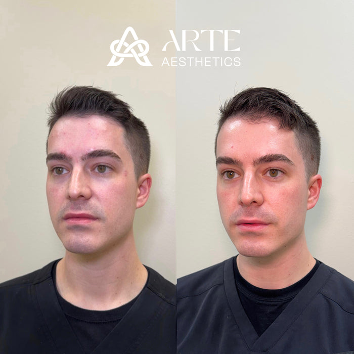 Collagen Restoration