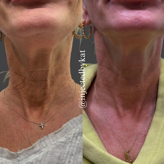 Collagen Restoration