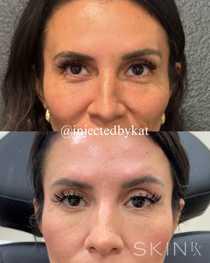 Collagen Restoration