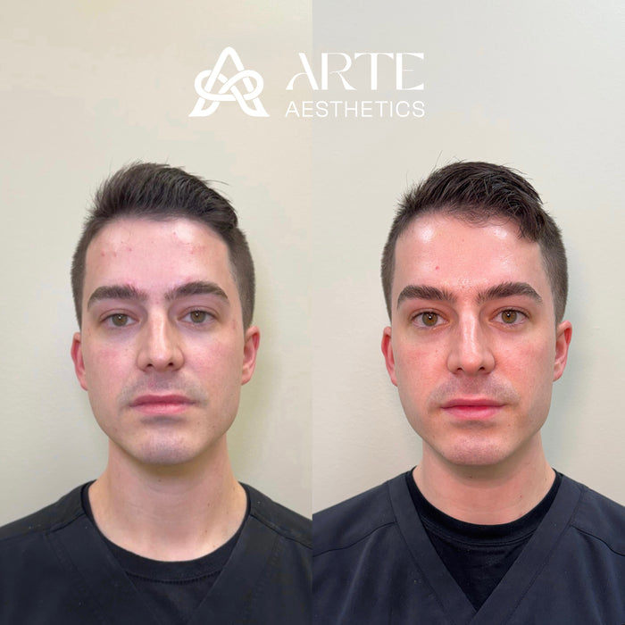 Collagen Restoration