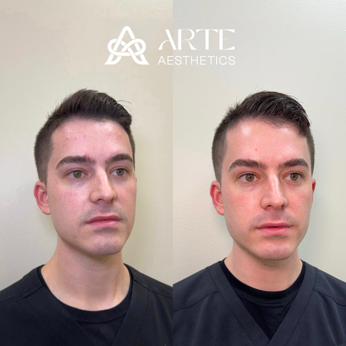 Collagen Restoration