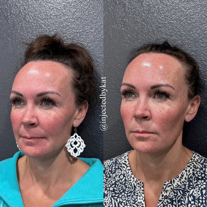 Collagen Restoration