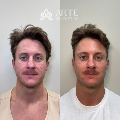 Before and after