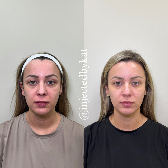 Restore & Contour