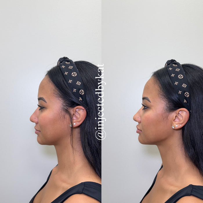 Restore & Contour
