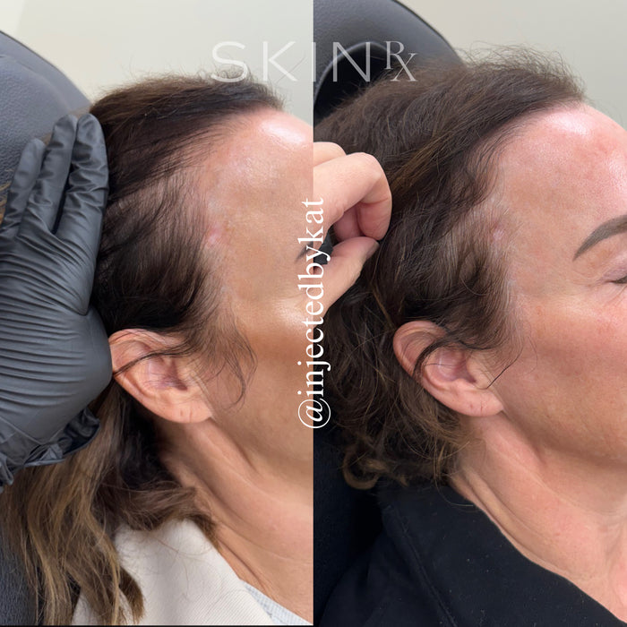 Hair & Scalp Renewal