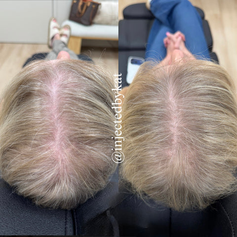 Before and after
