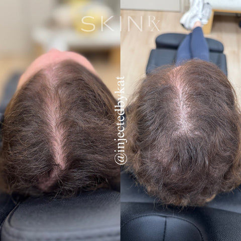 Before and after