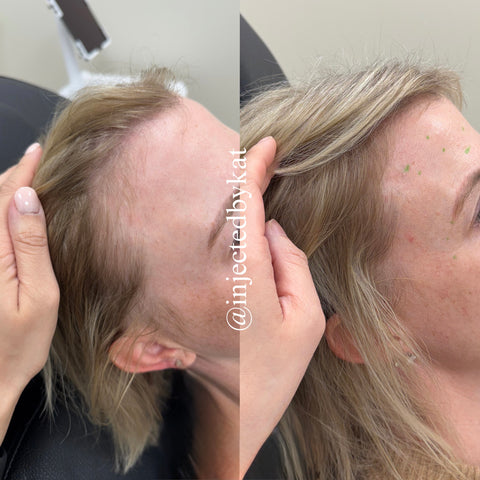 Before and after