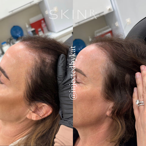 Before and after