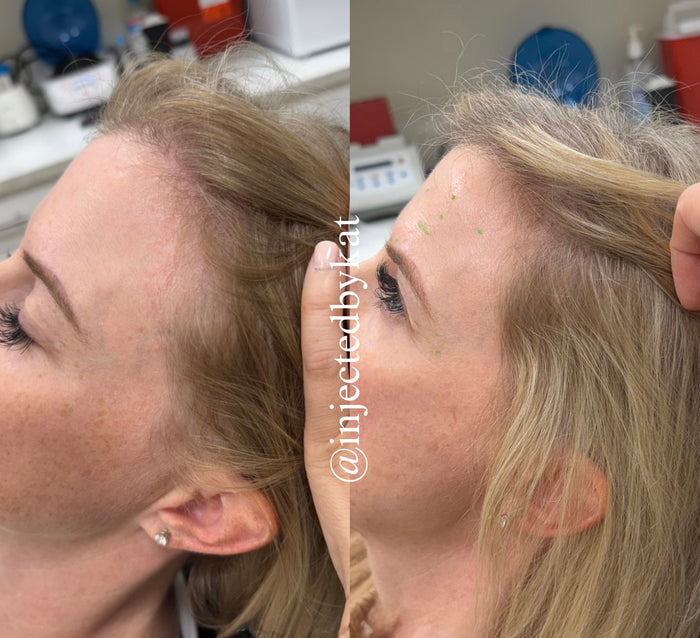 Hair & Scalp Renewal