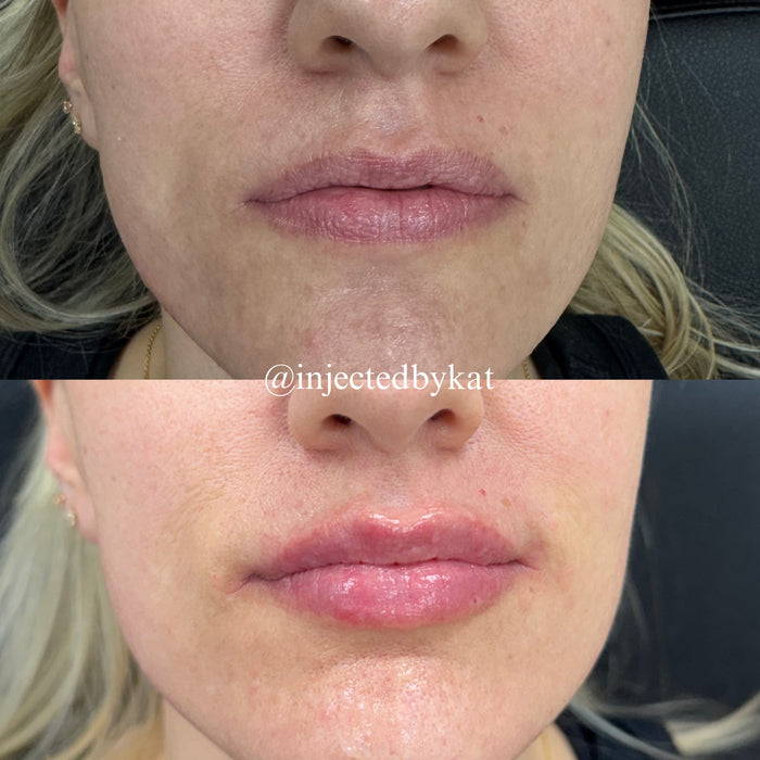Lip-ARTEistry