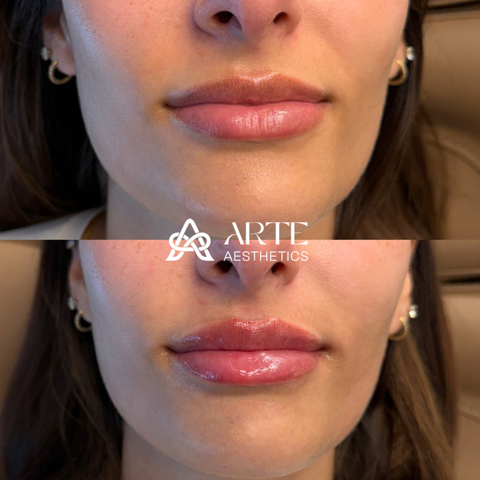 Lip-ARTEistry