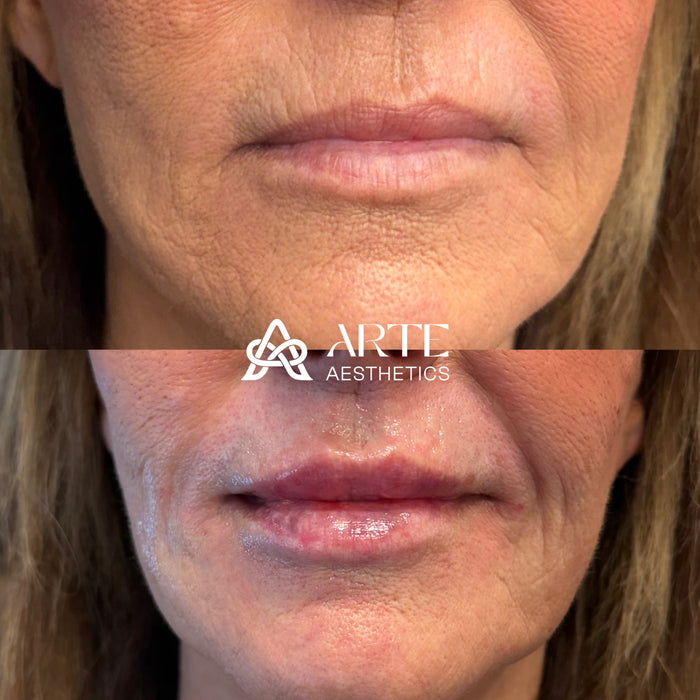 Lip-ARTEistry