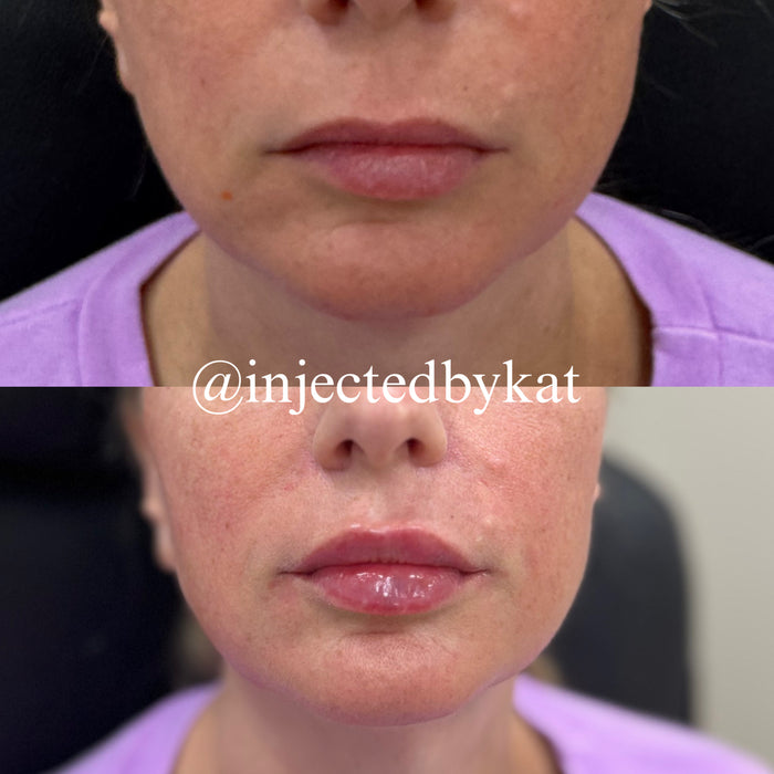 Lip-ARTEistry