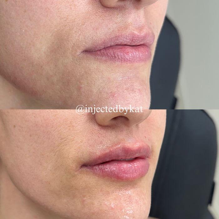 Lip-ARTEistry