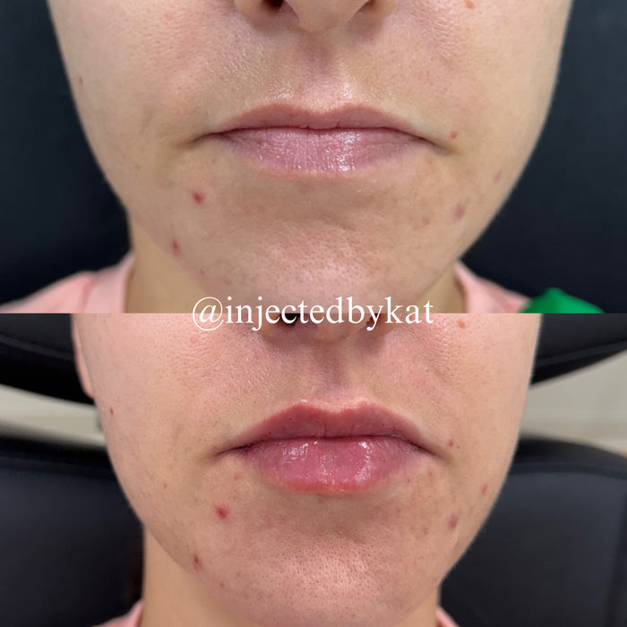 Lip-ARTEistry