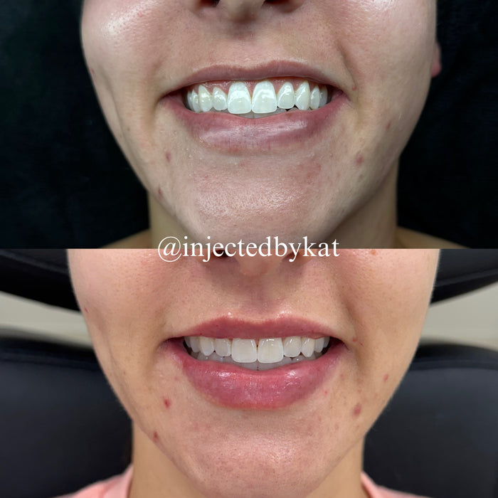 Lip-ARTEistry