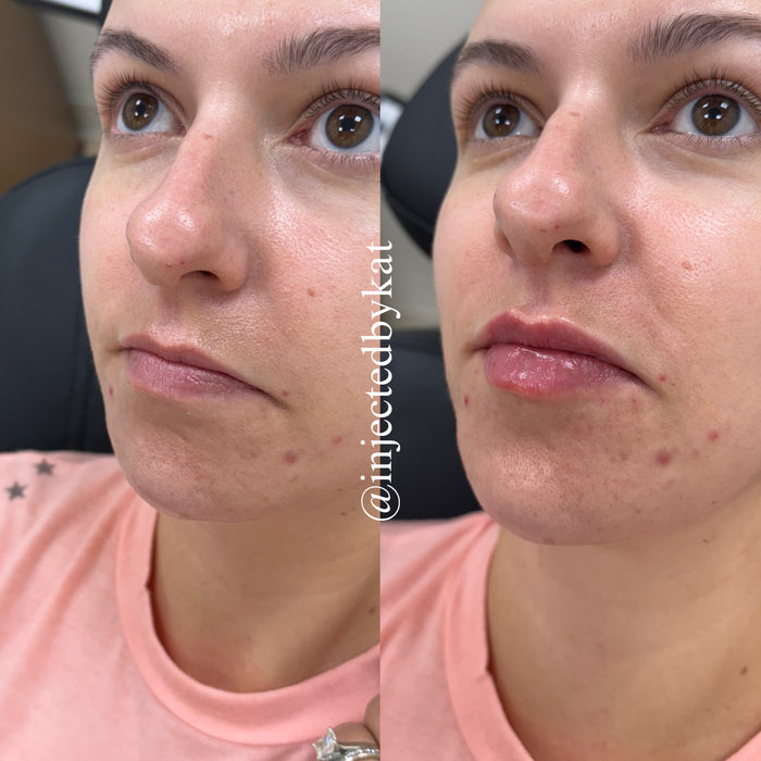 Lip-ARTEistry