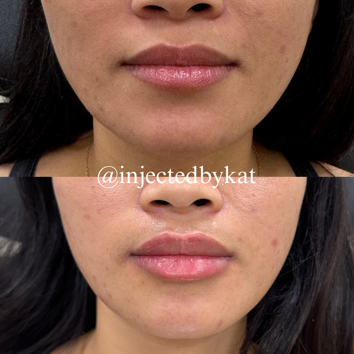 Lip-ARTEistry