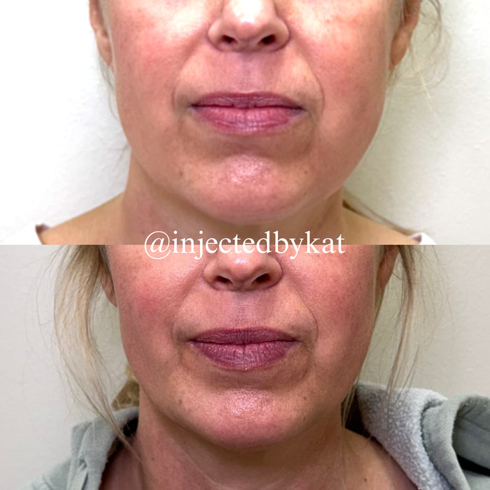 Lip-ARTEistry
