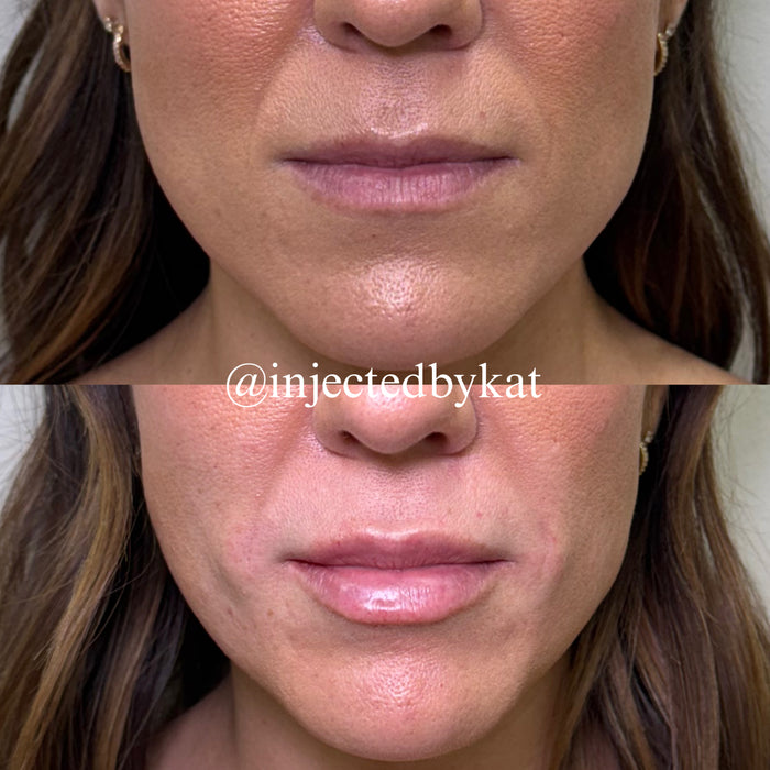 Lip-ARTEistry