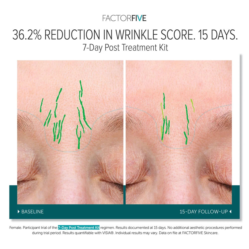 FACTORFIVE 7-Day Post-Treatment Kit