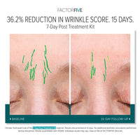 FACTORFIVE 7-Day Post-Treatment Kit
