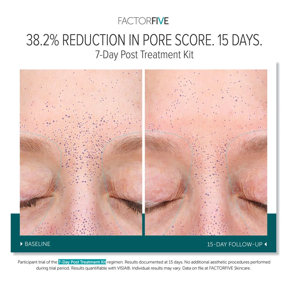 FACTORFIVE 7-Day Post-Treatment Kit