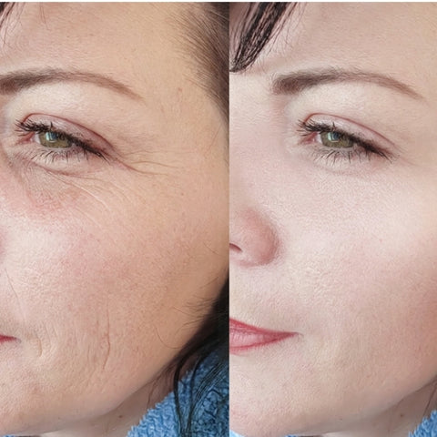 Before and after