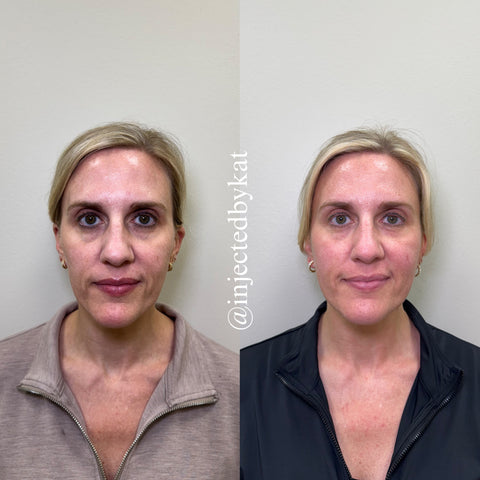 Before and after