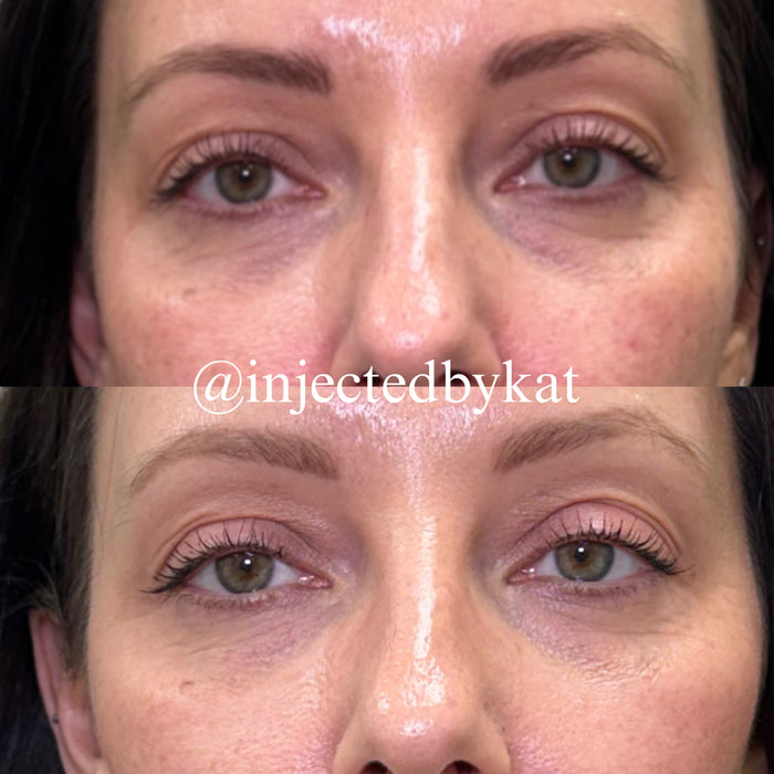Under Eye Refresh