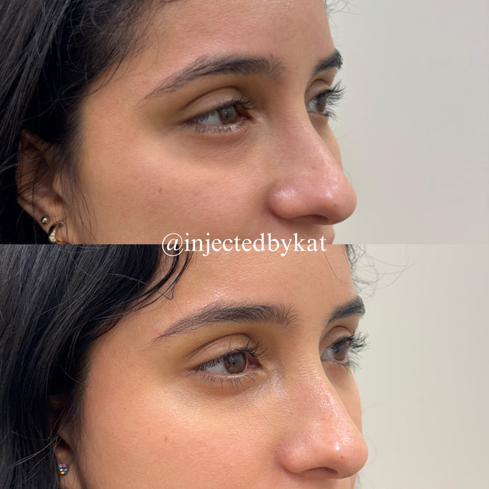 Under Eye Refresh