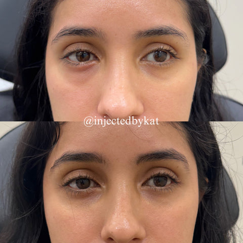 Before and after