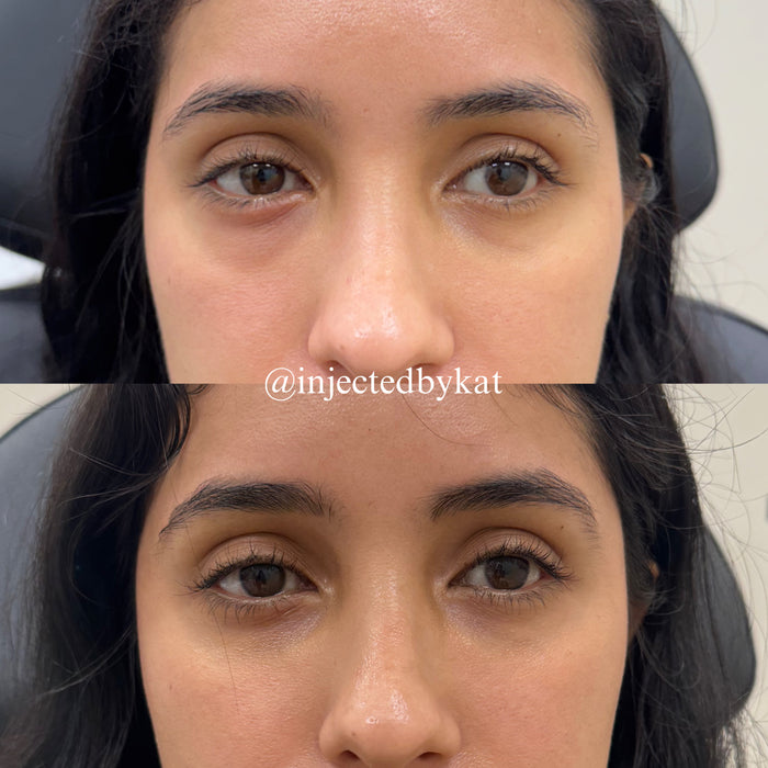 Under Eye Refresh