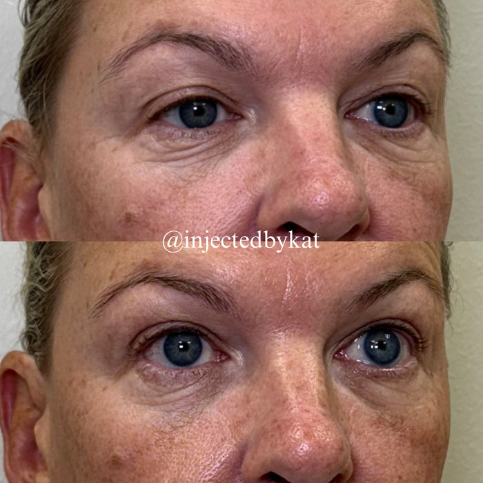 Under Eye Refresh