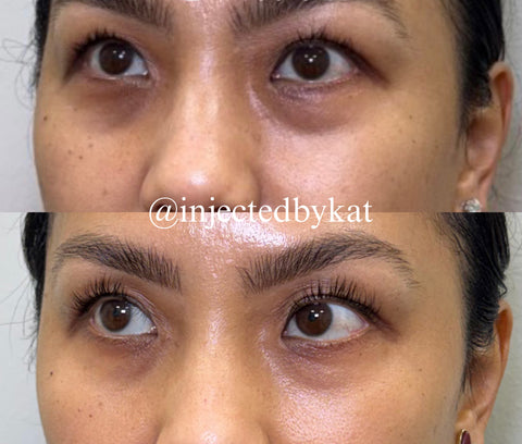 Before and after