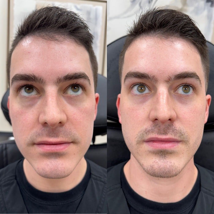 Under Eye Refresh