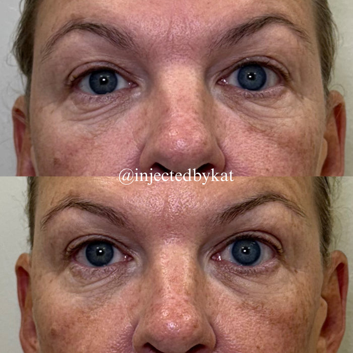 Under Eye Refresh